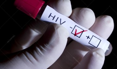 Umuntu wakane ku isi yakize Sida