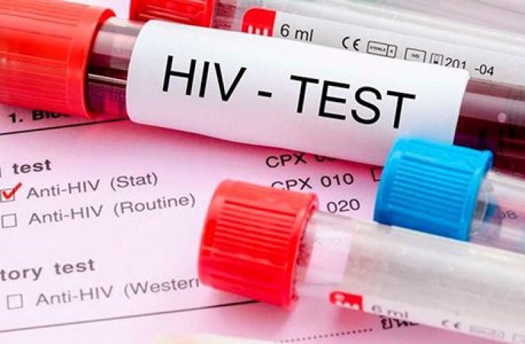 Ibiciro by'umuti wa Sida byashyizwe ahagaragara.