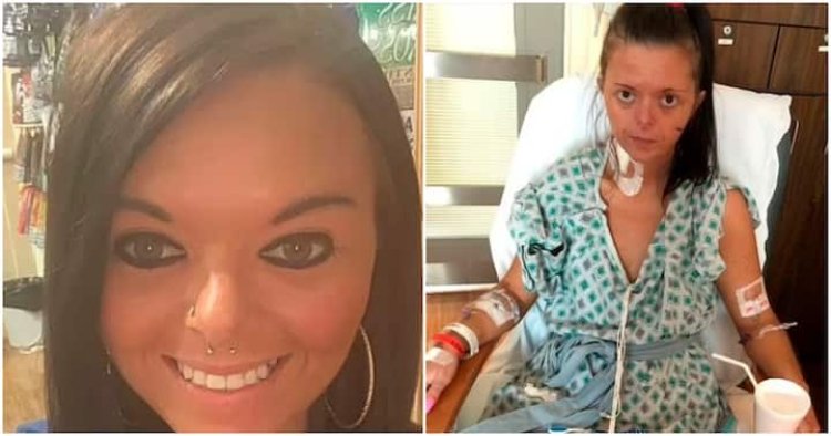 Umukobwa bamusanganye kanseri y'ibihaha nyuma yaho yanywaga isigara 50 ku munsi