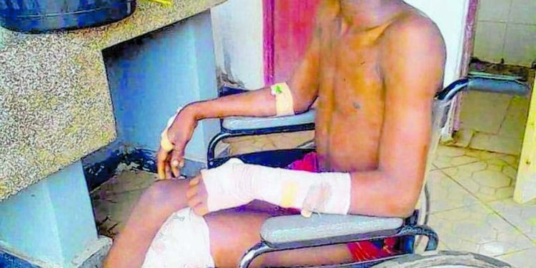 Umunyeshuri yakubiswe na mwalimu bimuviramo gukomereka azira kwiba Amandazi ane