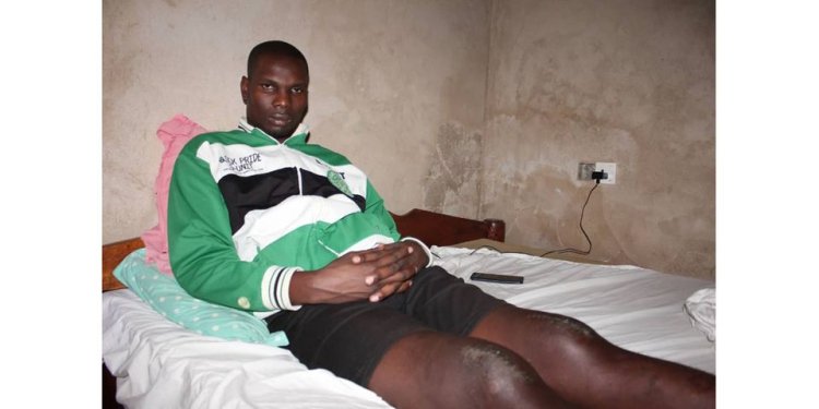 Umusore wakubiswe n'Umupolisi byamuviriyemo kubagwa