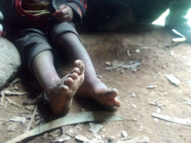 Musanze: Nyakatsi yo kuburiri intandaro y'amavunja adacika kubasigajwe inyuma n'amateka