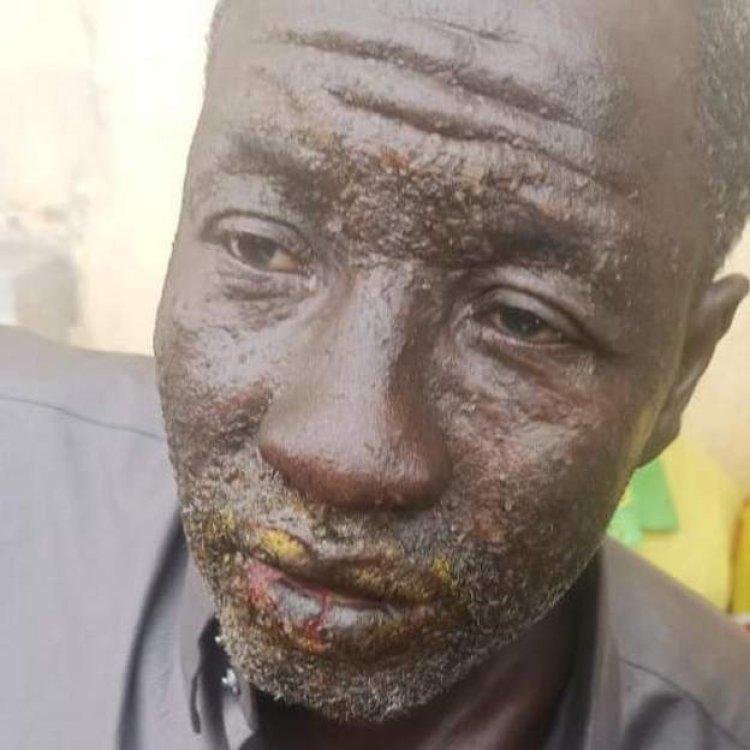 Hadutse icyorezo kitazwi kibasiye abarobyi