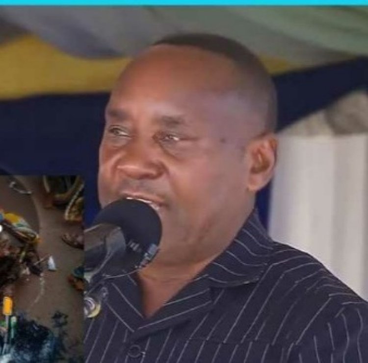 Depite Francis yitabye Imana  azize impanuka